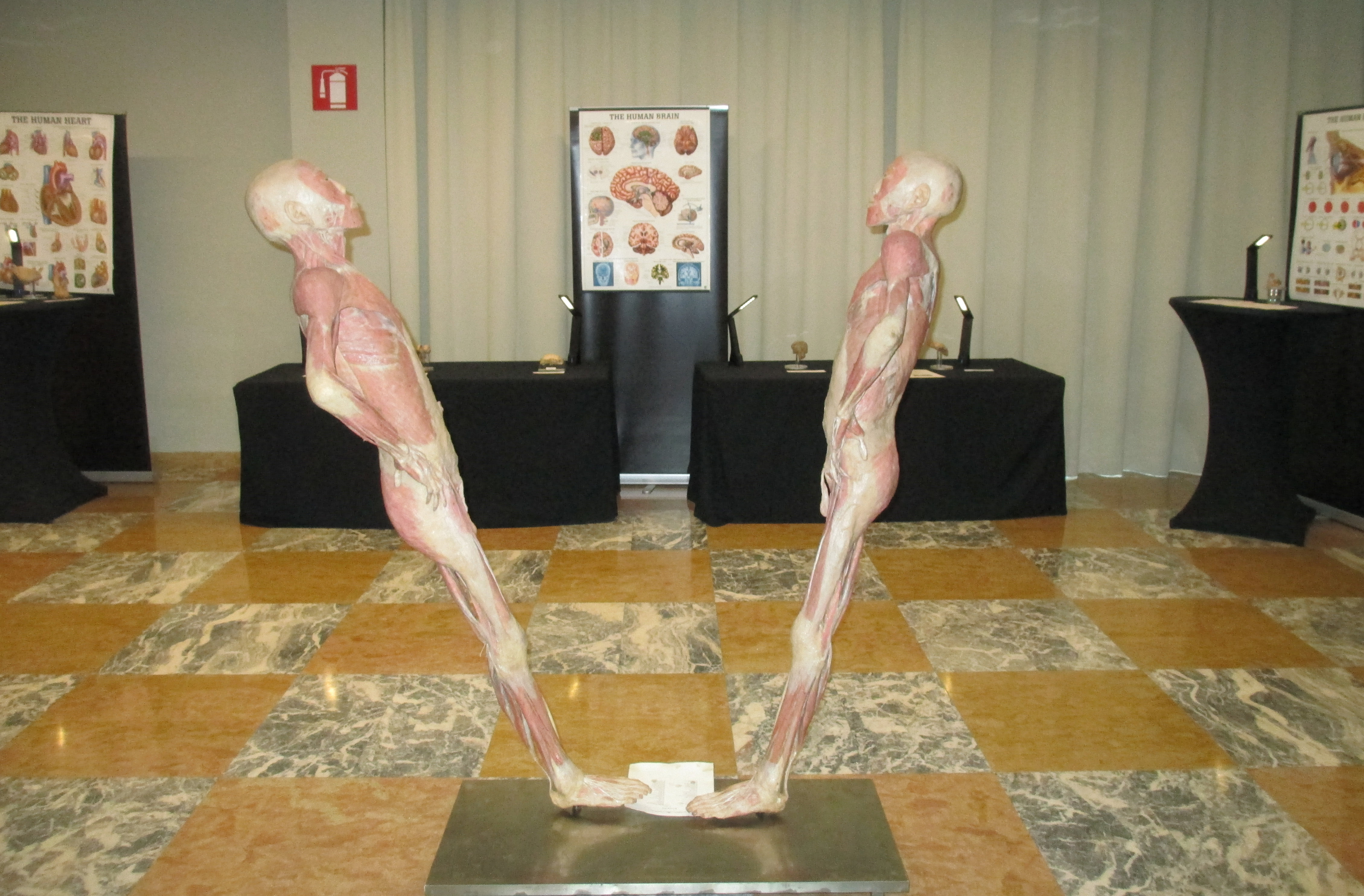 Read more about the article THE BODY EXHIBITION